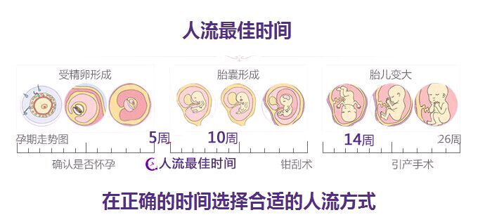 呼和浩特学院无痛引产医院：中期引产后多久可以再要孩子